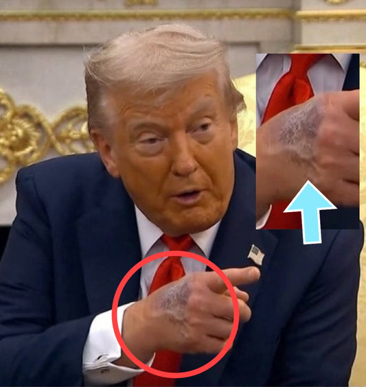 Give President Trump a herbal advice